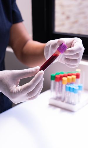Próbki laboratoryjne